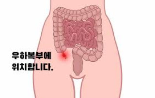 맹장염 가이드: 증상부터 수술, 회복 식단 총정리