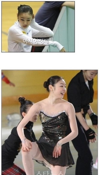 인터뷰고 뭐고 가려운 김연아 - 가려움증의 고통은 너무도 고통스럽다