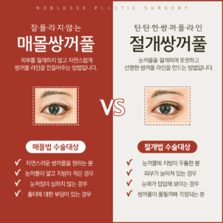 쳐진 눈 성형 수술로 새롭게 태어나는 방법