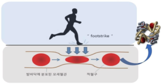 운동 빈혈(스포츠 빈혈)