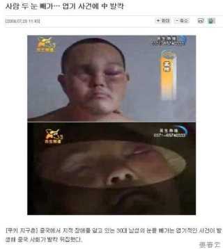 엽기 도둑질 - 지적 장애자의 눈을 훔쳐가