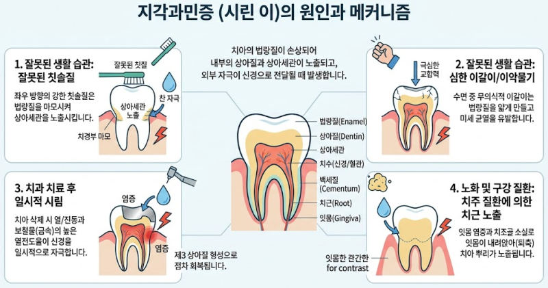 이빨이 시려지는 원인