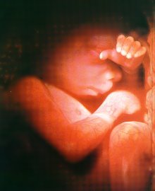 태아보험은 왜 태아때 가입하는가?