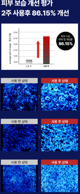 피부 침투력 끝판왕 앰플 - 끌림끌램 세라바이오틱스, 마녀공장, 로투에, 토리든 등 4종 비교