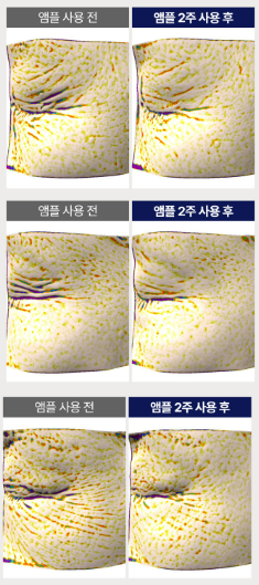 피부 침투력 끝판왕 앰플 - 끌림끌램 세라바이오틱스, 마녀공장, 로투에, 토리든 등 4종 비교